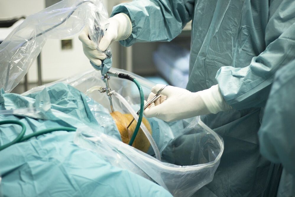 chirurgická léčba artrózy